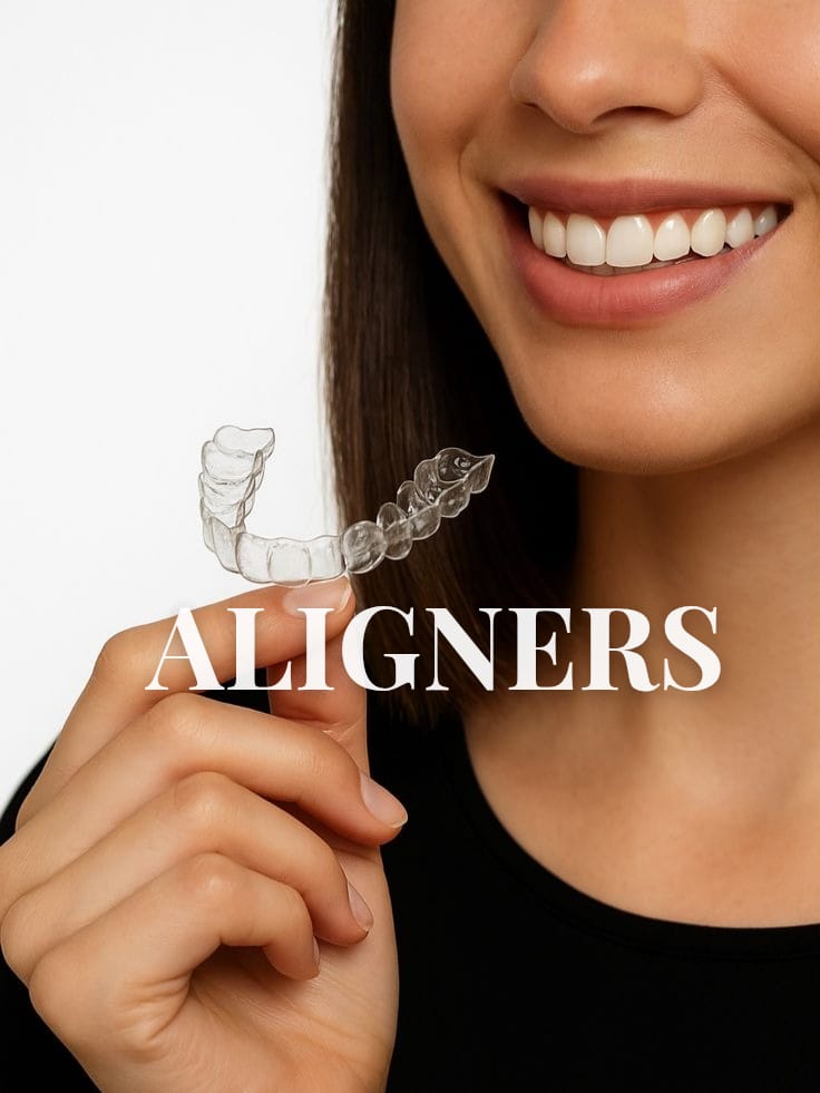 aligners